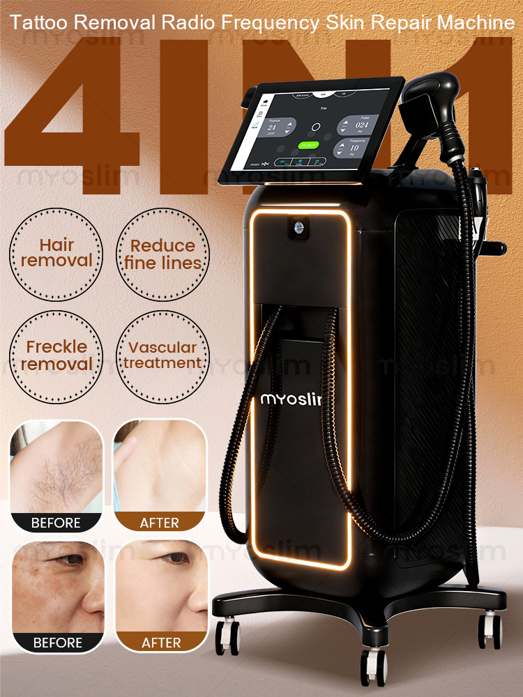 Maszyna do depilacji laserowej – Industrial Laser Hair Removal Machine recenzja i cena